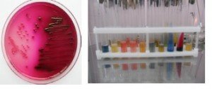 Рисунок 1 - Микробиологическая диагностика бактерий группы кишечных палочек на селективных средах